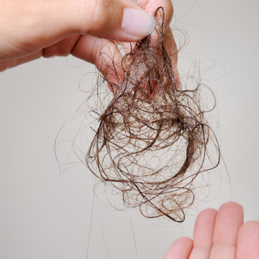 Hair loss after showering